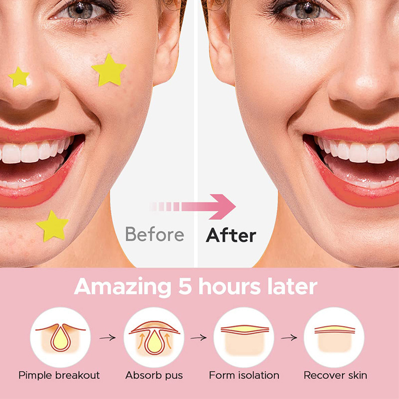600 قطعة/مجموعة لاصقات نجمية ل - مراجعة Beauty Makeup & D Anime Studio Vega Baja وسعره