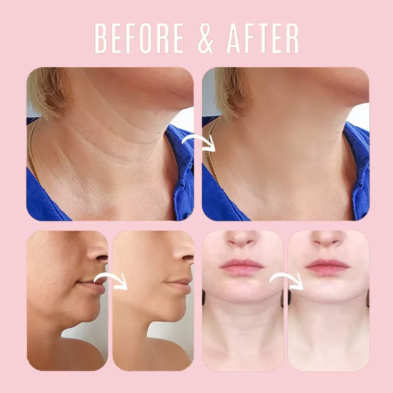 الكولاجين إزالة التجاعيد متعدد - مراجعة Beauty Makeup Cream وسعره